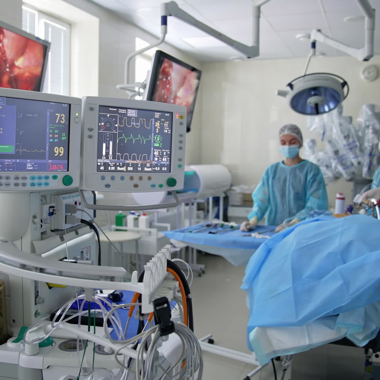 Monitor in un reparto di terapia intensiva. Battito cardiaco di un paziente sullo schermo dei computer durante un intervento in ospedale. Concetto di assistenza sanitaria