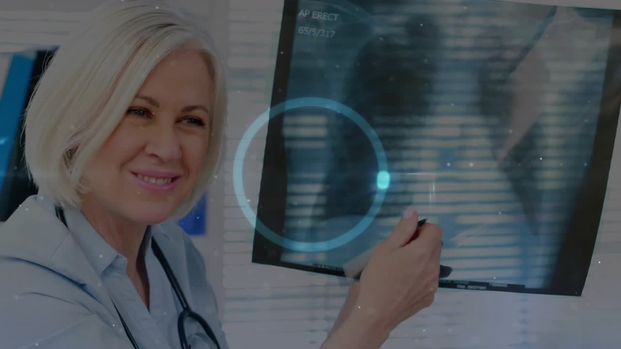 Médico mostrando una radiografía de tórax, señalando con un bolígrafo mientras el paciente sigue el diagnóstico a través de una superposición.