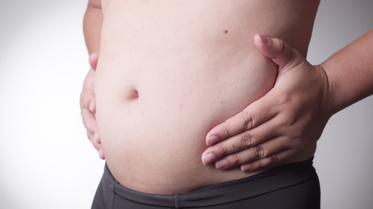 Fat belly man suffering from a metabolic disorder, stomach resection, liposuction