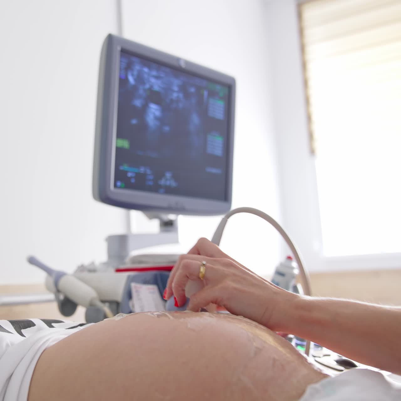 Obstetric Ultrasound scans. Ultrasound investigation of pregnant woman. Pregnancy and Healthcare concept. Process of fetus ultrasonography