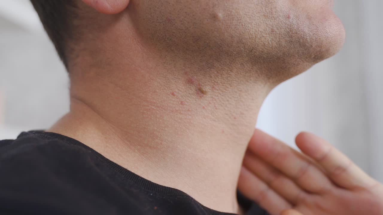 dolor de garganta. hombre enfermo. el hombre con el bocio.