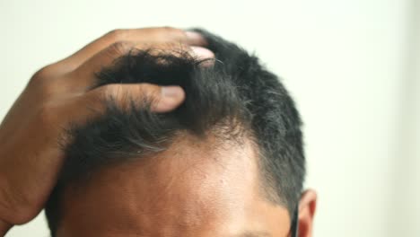 closeup of a man's head and hair