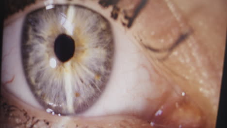 Close-up of Eye During Retinal Examination