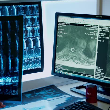 surgeon examining x ray film