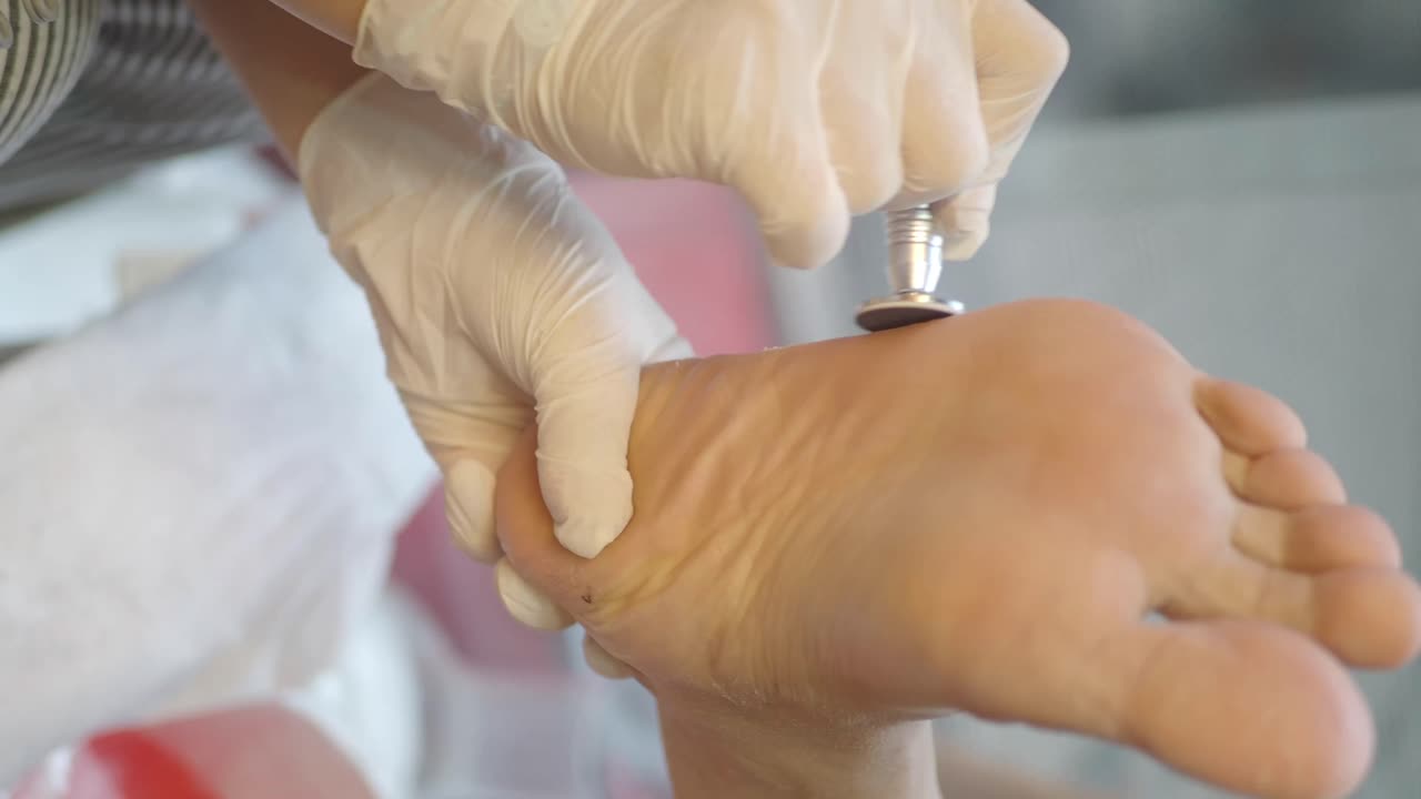 Trattamento professionale per la cura dei piedi
