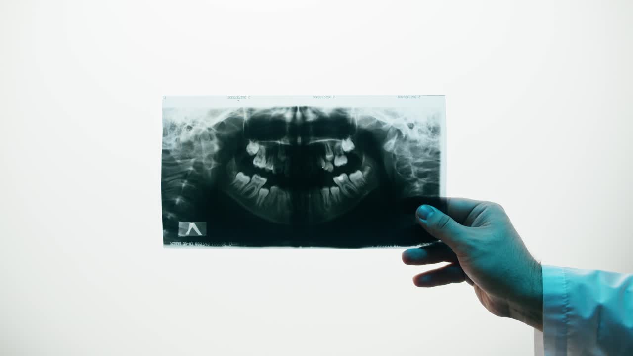 Doctor Holding and Examining a Panoramic Dental X-Ray