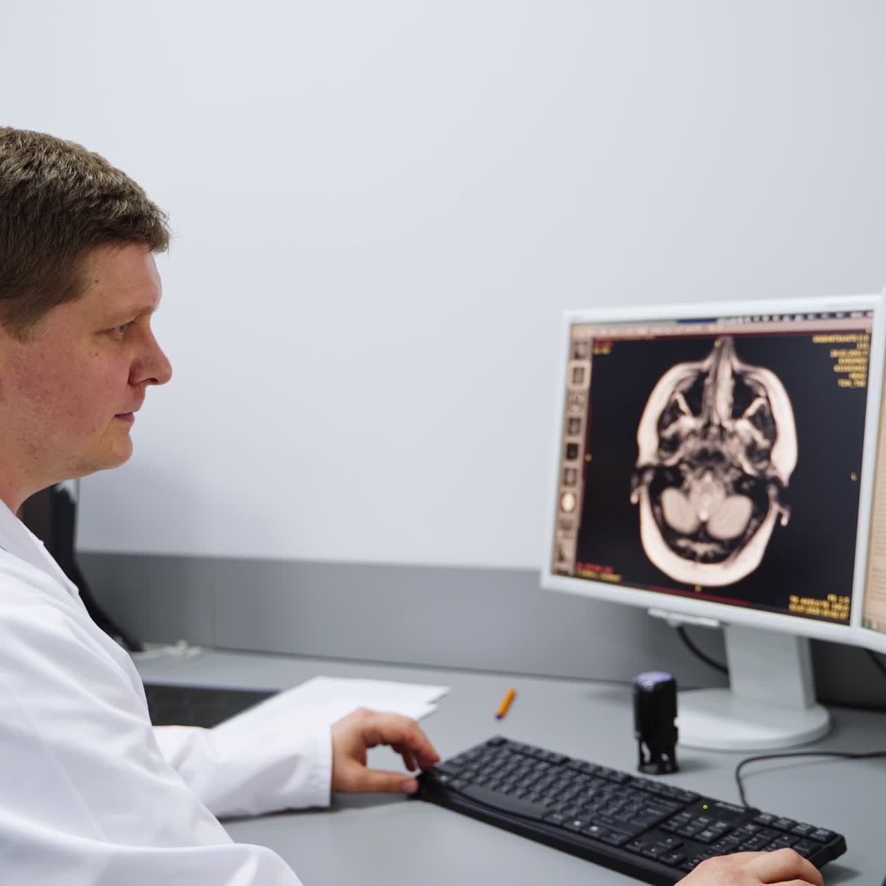Tecnico di laboratorio in ospedale seduto davanti al computer. Attento, il medico osserva la scansione della testa analizzando l'immagine ed eseguendo la diagnosi