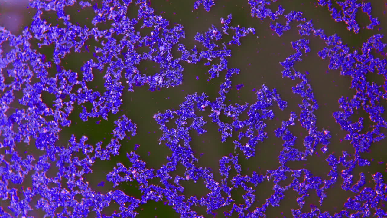 Microscopic view of purple bacteria colonies