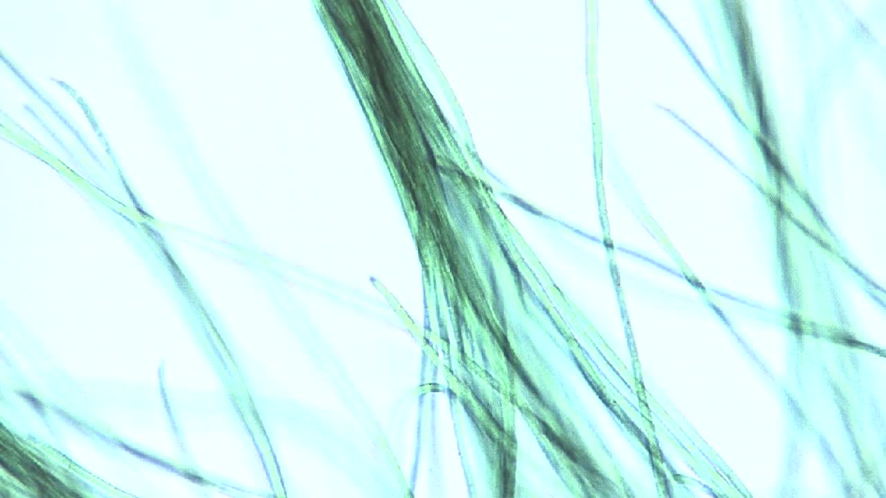 vista microscópica de cintas o filamentos de algas 1