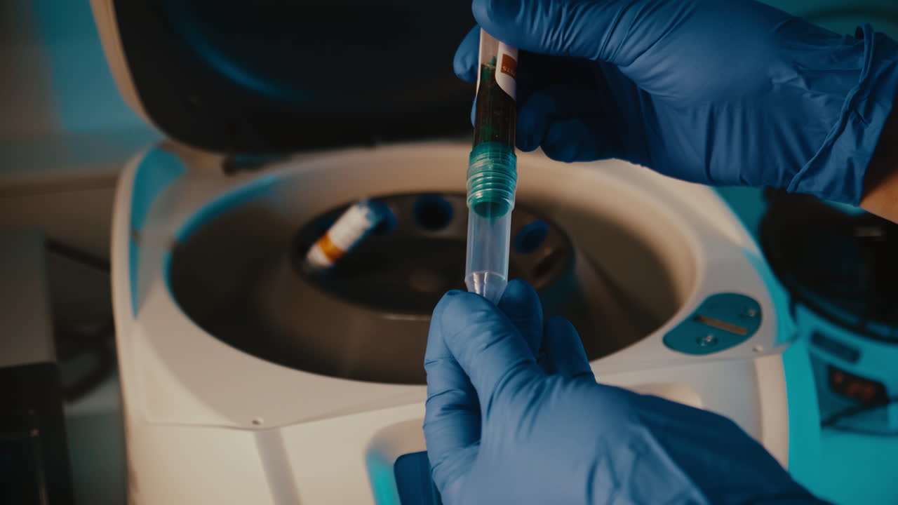 A laboratory sample is insterted to a centrifuge and closed.