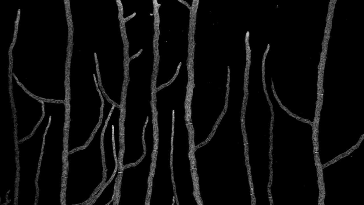 시간 경과 공초점 현미경을 사용하여 이미지화된 곰팡이 균사, 신경포자 크라사 균사체의 아름다운 나무와 같은 성장 및 분기