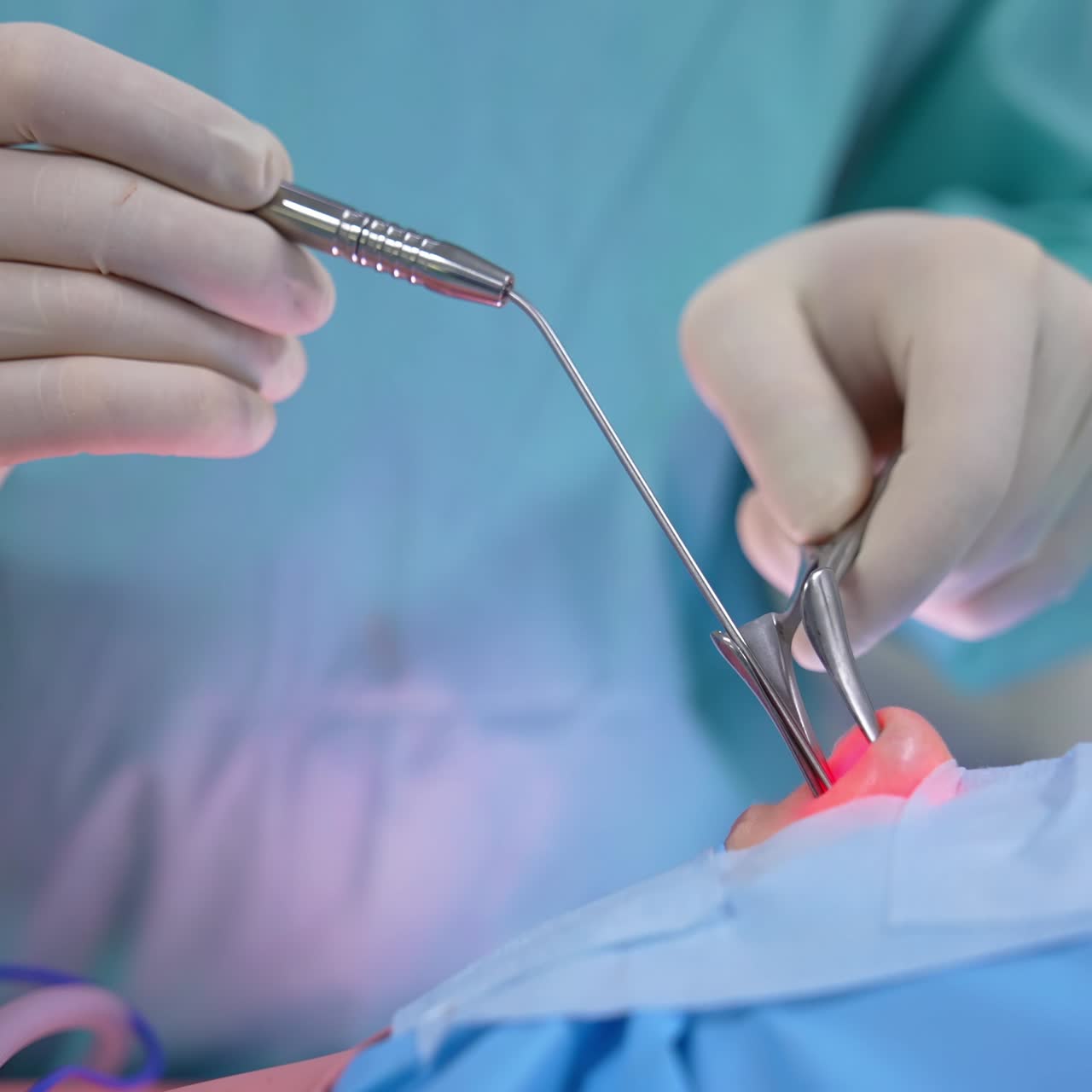 Doctor doing nasal surgery with modern equipment. Surgeon's hands uses surgical instrument while doing operation in a nose. Close-up