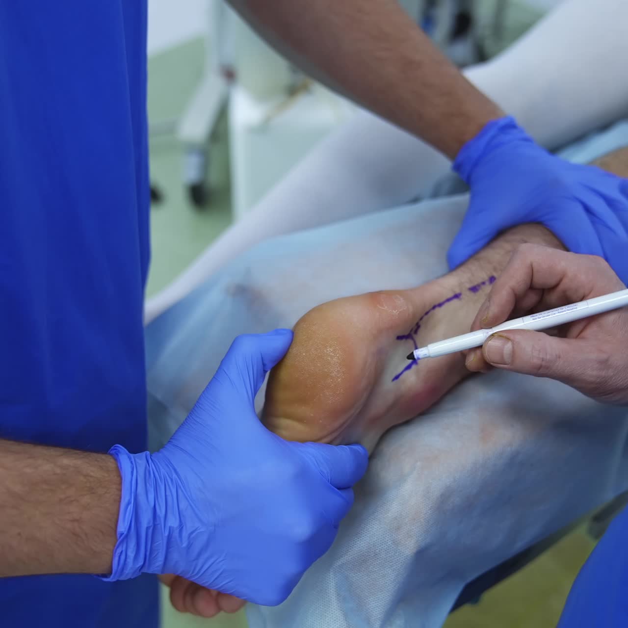 Patient's leg on surgical table. Surgeons preparing leg before the operation. Medical procedure in the surgical room. Close-up