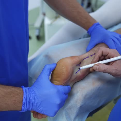 patient's leg on surgical table. surgeons preparing leg before the operation. medical procedure in the surgical room. close-up