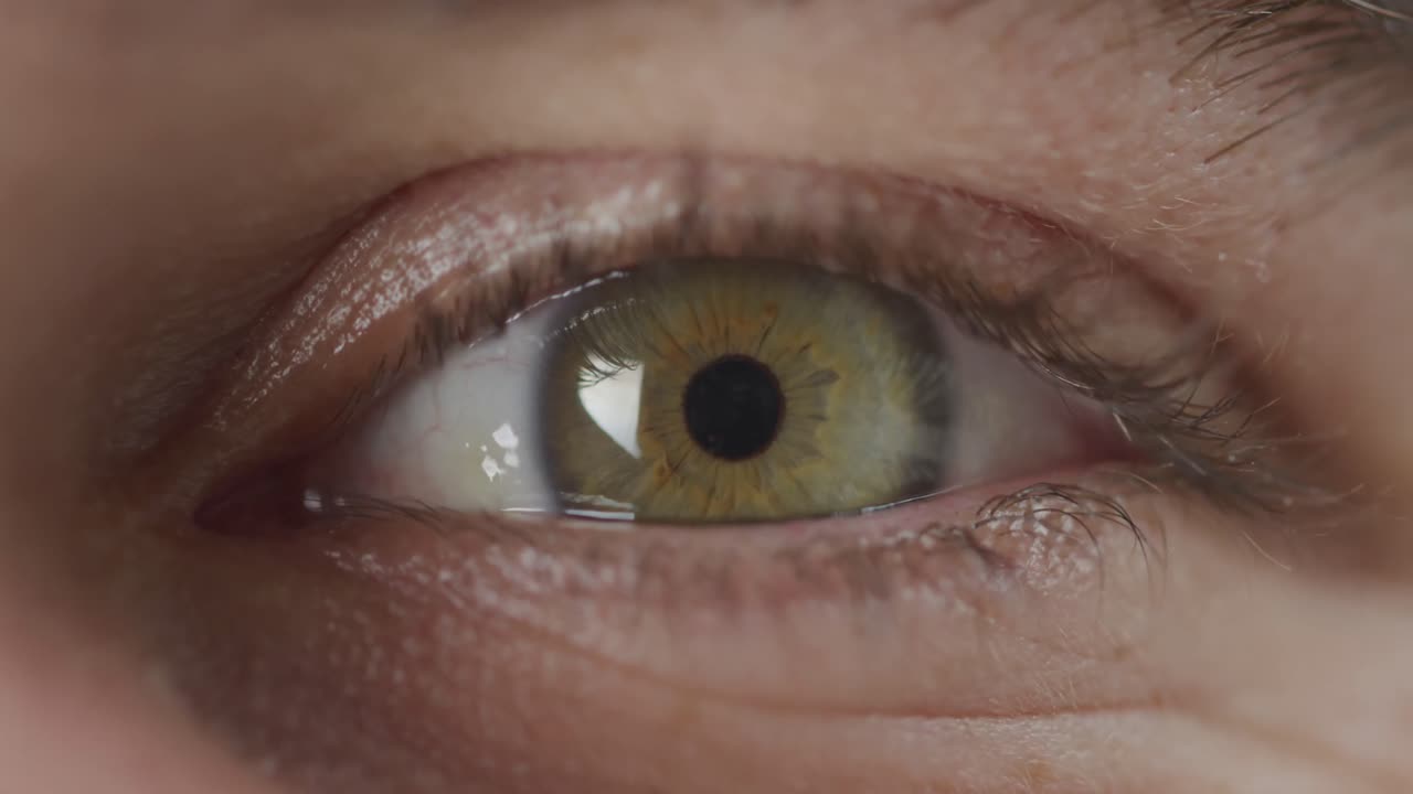 녹색 눈이  ⁇ 박이고