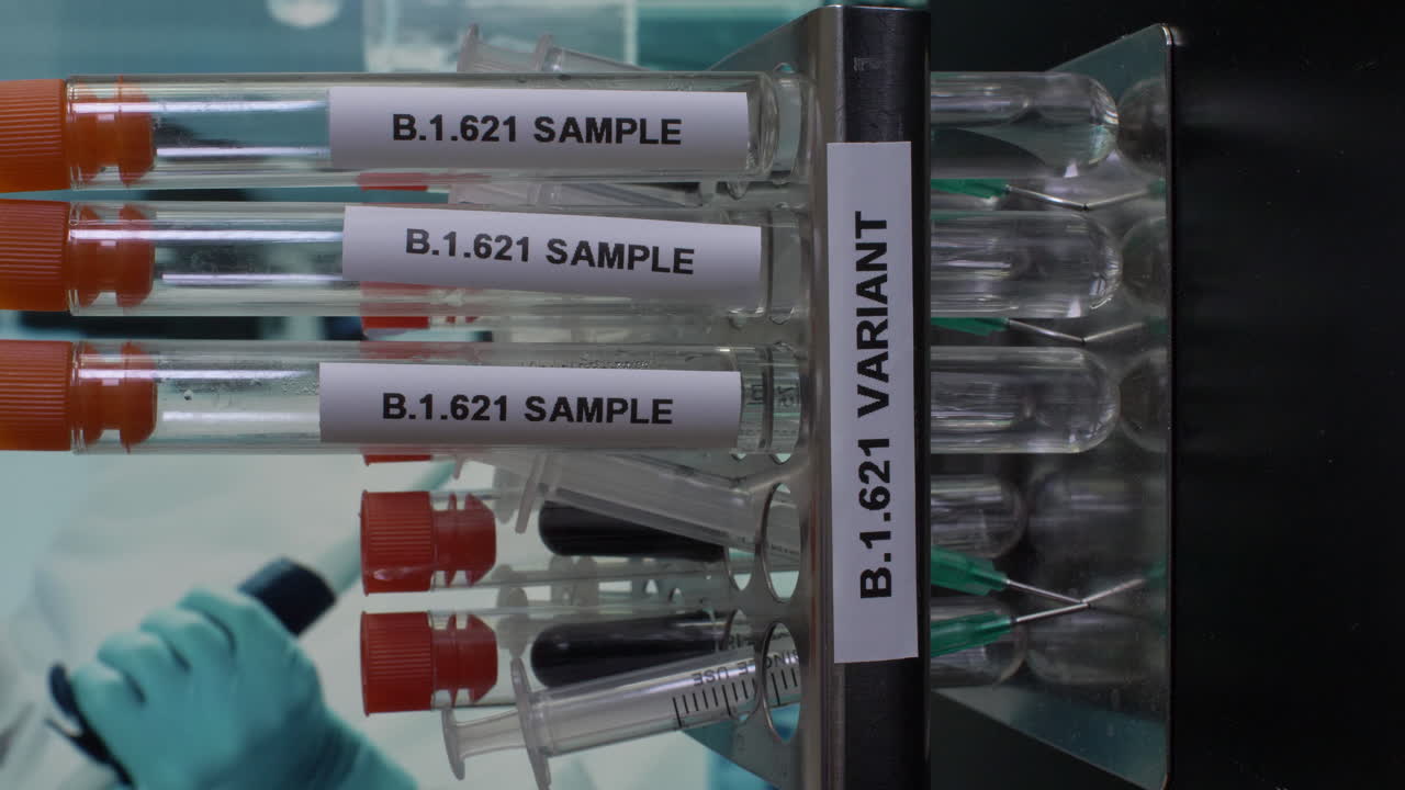 b) El número de miembros del Consejo de Administración;