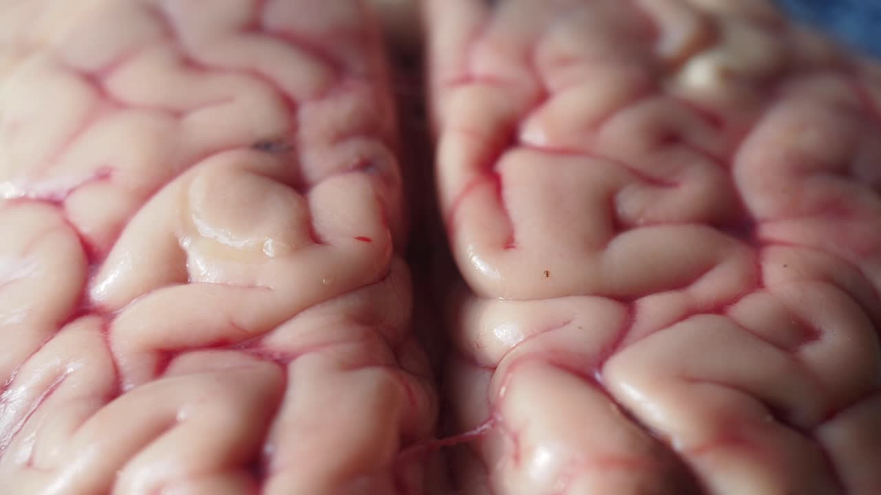 Close-up of a raw brain