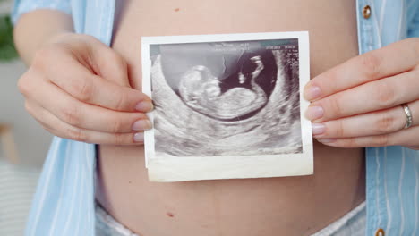 woman holding ultrasound image of baby