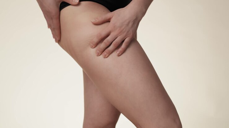 Unrecognizable woman touching and pressing skin on her hip