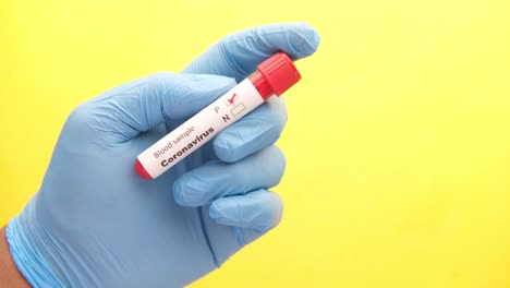 prueba de muestra de sangre de coronavirus