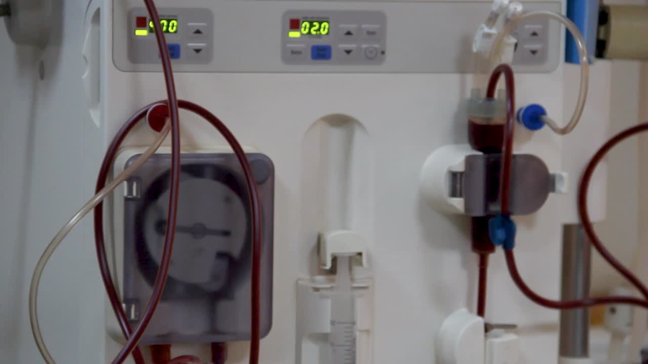Sangue che scorre attraverso la macchina per dialisi renale
