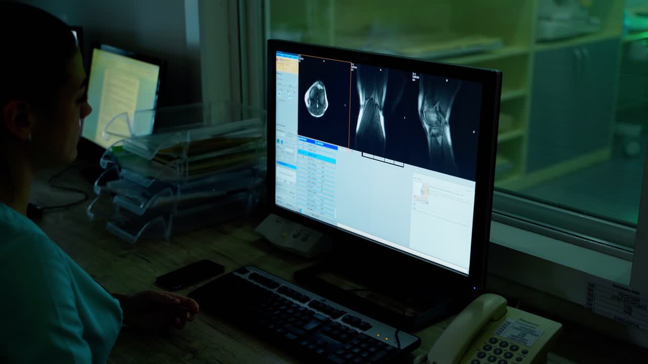 Medical specialist examining patient's bones on monitor. Female doctor is looking at scans of a patient on computer screen in clinic.