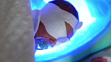 little baby in a special eyes cover lies on the ultraviolet lamp. child with pacifier undergoing treatment of childhood jaundice. close up.