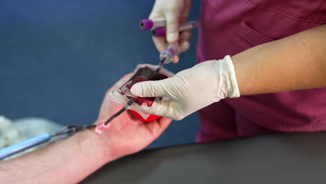 nurse takes a plastic bag filled with blood and fills the test tubes. blood donation concept. close up.