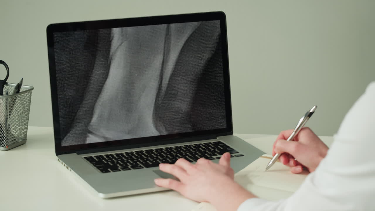 Doctor reviewing knee X-ray