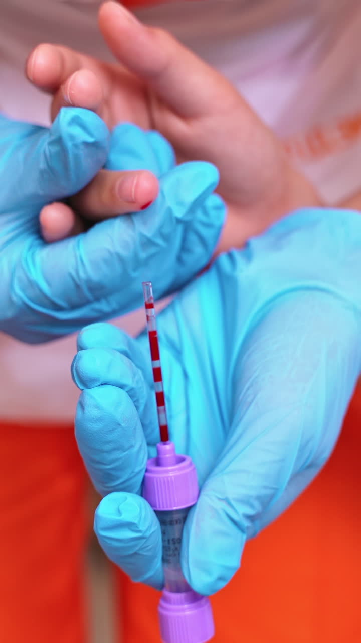 Nurse in collecting blood of a child's finger. Close-up of a medical technician in sterile gloves taking a sample of blood from patient's finger. Healthcare concept. Vertical video