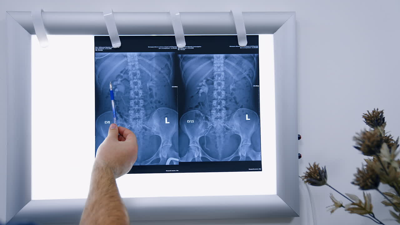 Obstetrician showing the x-ray scan of inner organs to a patient. Blonde woman in mask listens to a doctor and nods.
