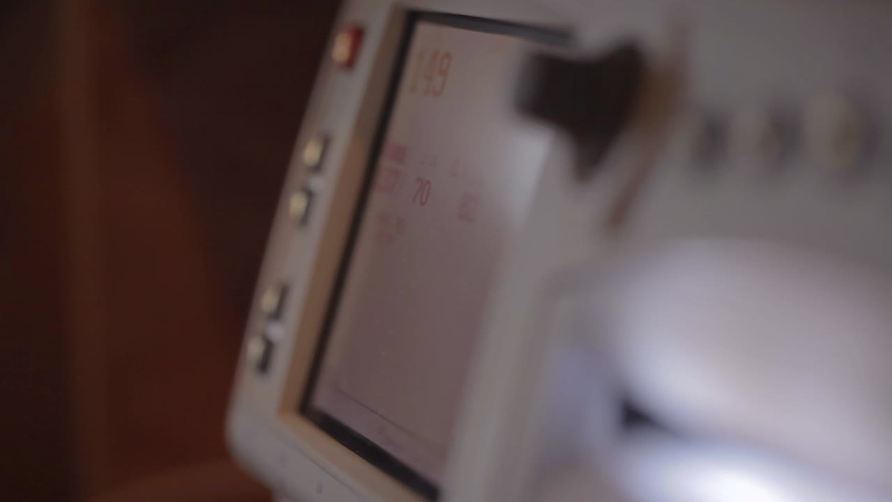 un monitor cardíaco del hospital monitorea a un bebé dentro de su madre embarazada que actualmente está en trabajo de parto