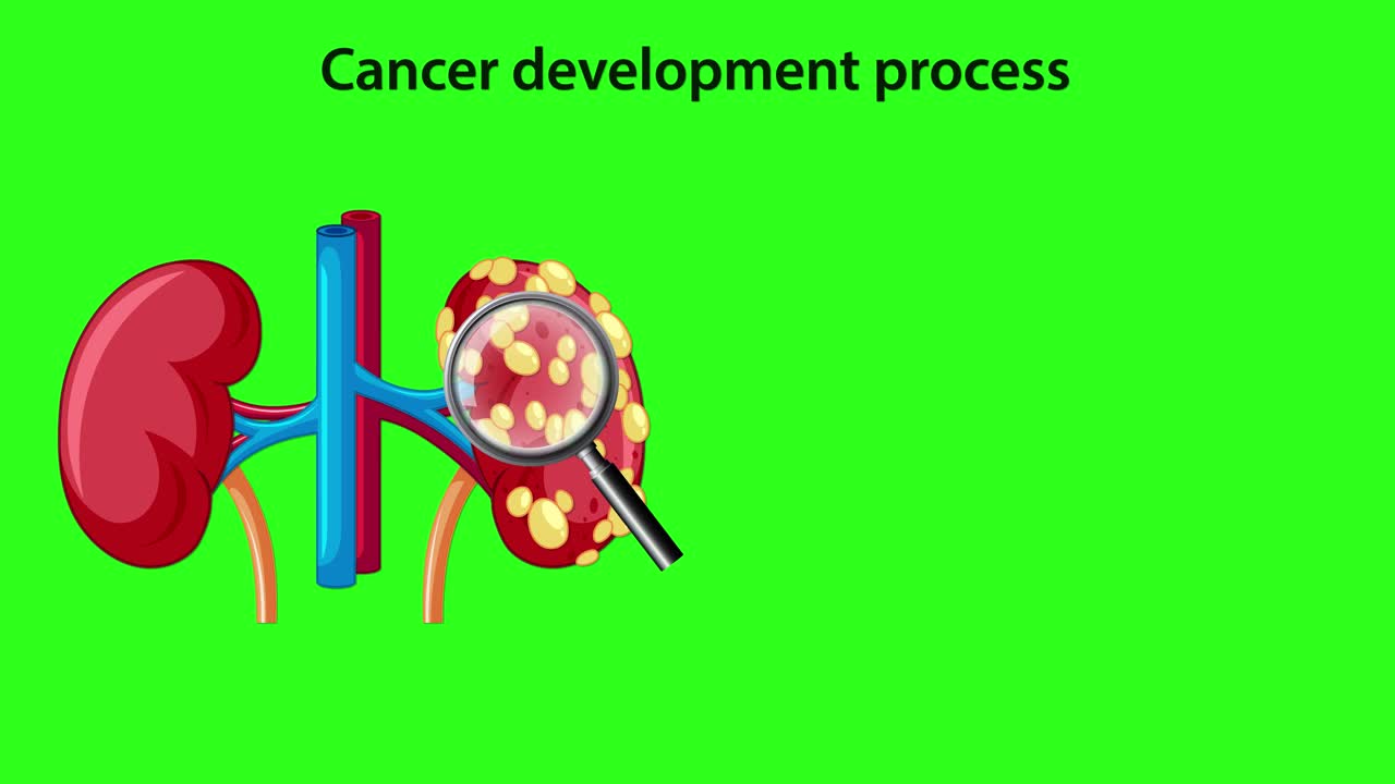Animated sequence illustrates the transformation of normal kidney cells into cancer cells, highlighting cell mutation, proliferation, and tumor growth with clear medical diagrams