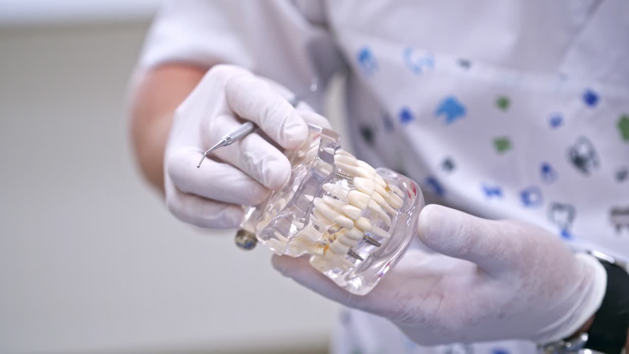 Doctor shows on a plastic jaw sample or model different methods of teeth treatment. Modern dental clinic background. Health concept. White medical gloves on male doctor's hands.