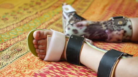 Child-cerebral-palsy-disability,-legs-orthosis