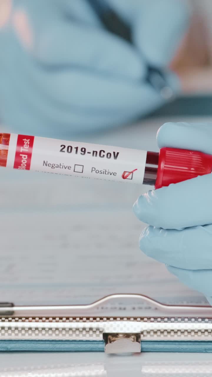 Healthcare professional conducts blood test for 2019ncov in clinical lab