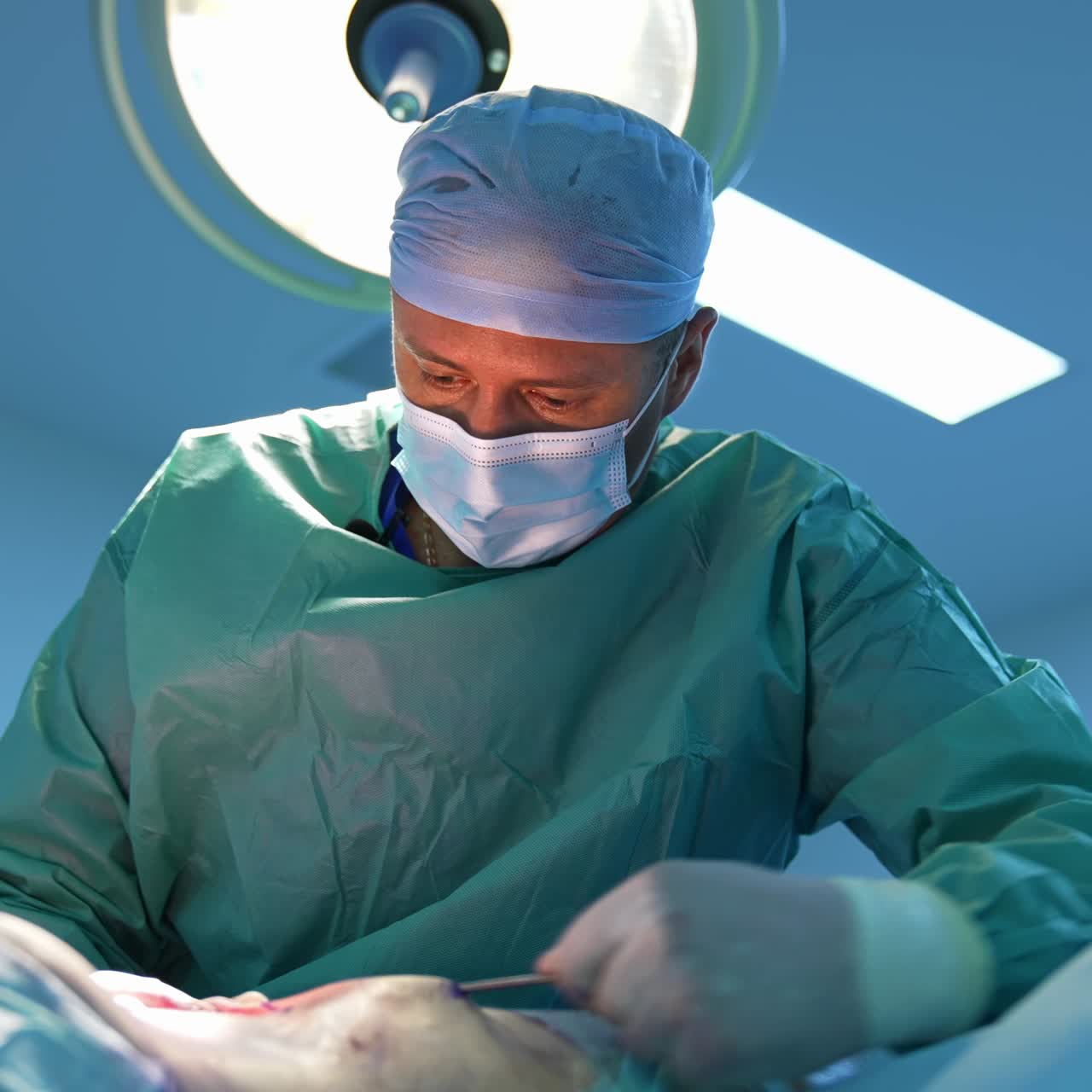 Performance of liposuction surgery by a medical professional. Body fat removal and fat transfer operation in the modern surgery. View from below