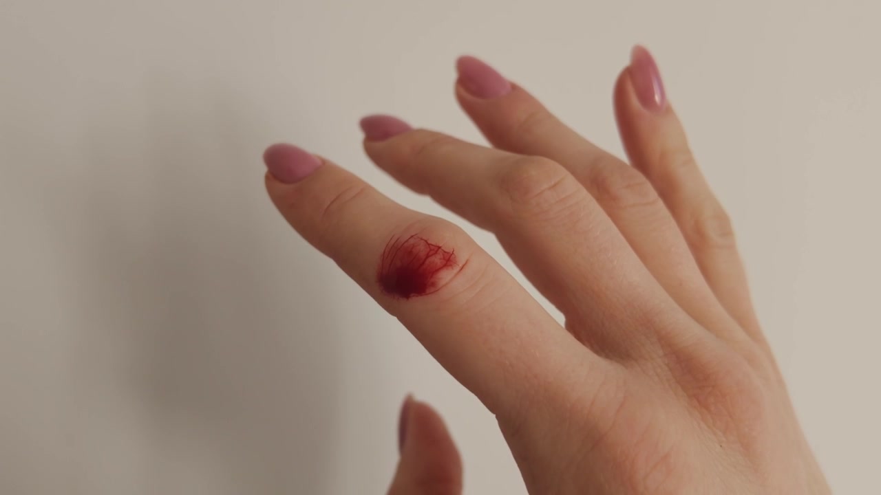 Close-up de mão feminina com a ponta do dedo danificada após um acidente doméstico do dia a dia
