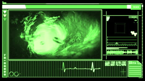 Digital-interface-showing-bloodflow-through-vein