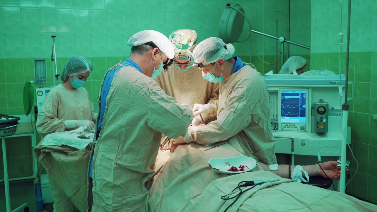 Medical team performing operation. Group of surgeon at work in operating theatre