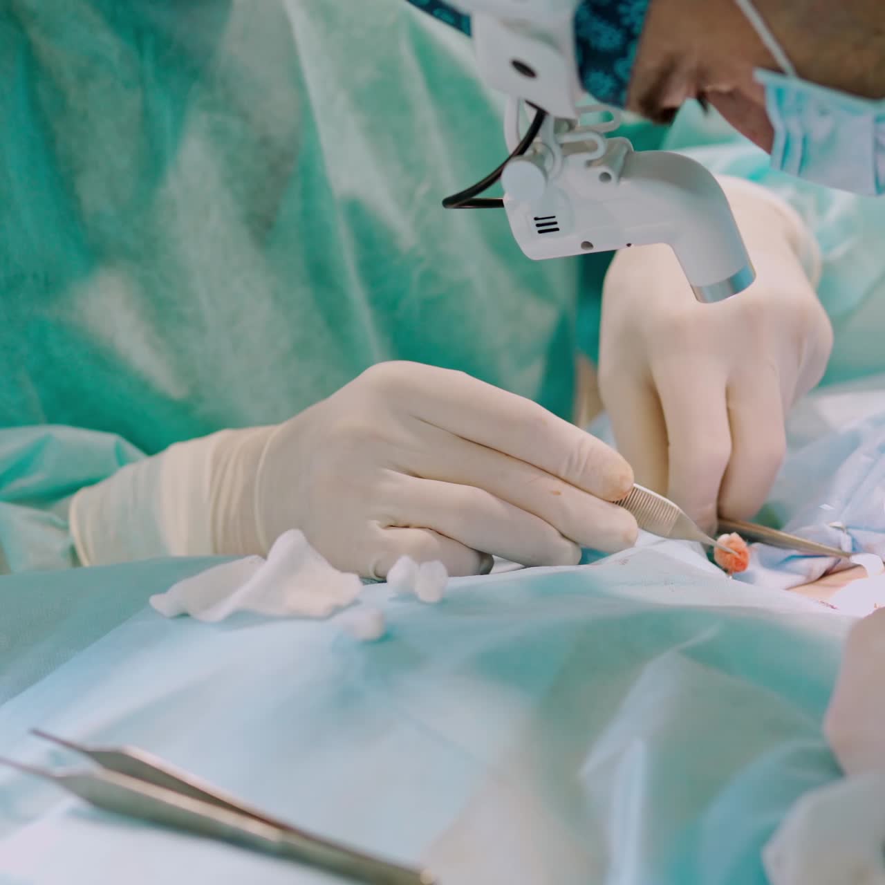 Operation on patient. Hands in sterile gloves with surgical tools of doctors during surgery. Teamwork of medical workers in the operating room. Close-up.