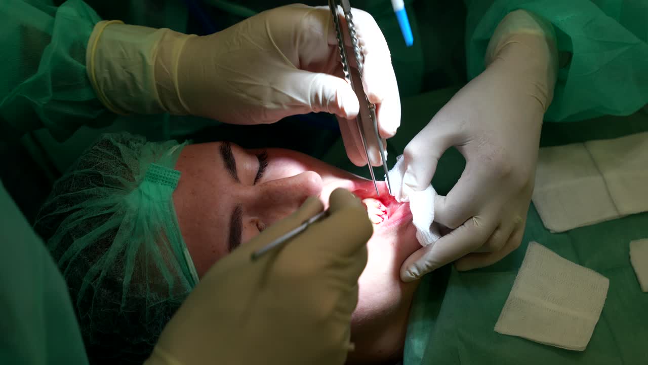 médico cortando un pedazo de piel de su paciente femenina durante una cirugía de injerto dental
