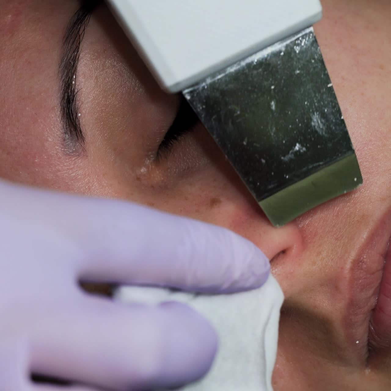 Cleaning the skin imperfections with ultrasonic scrubber. Beautician moves the cosmetic device around the female nostrils. Extreme close up