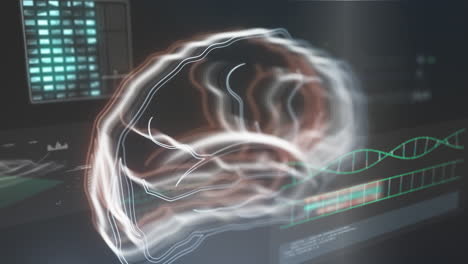 medical computer screen with tomography of human brain