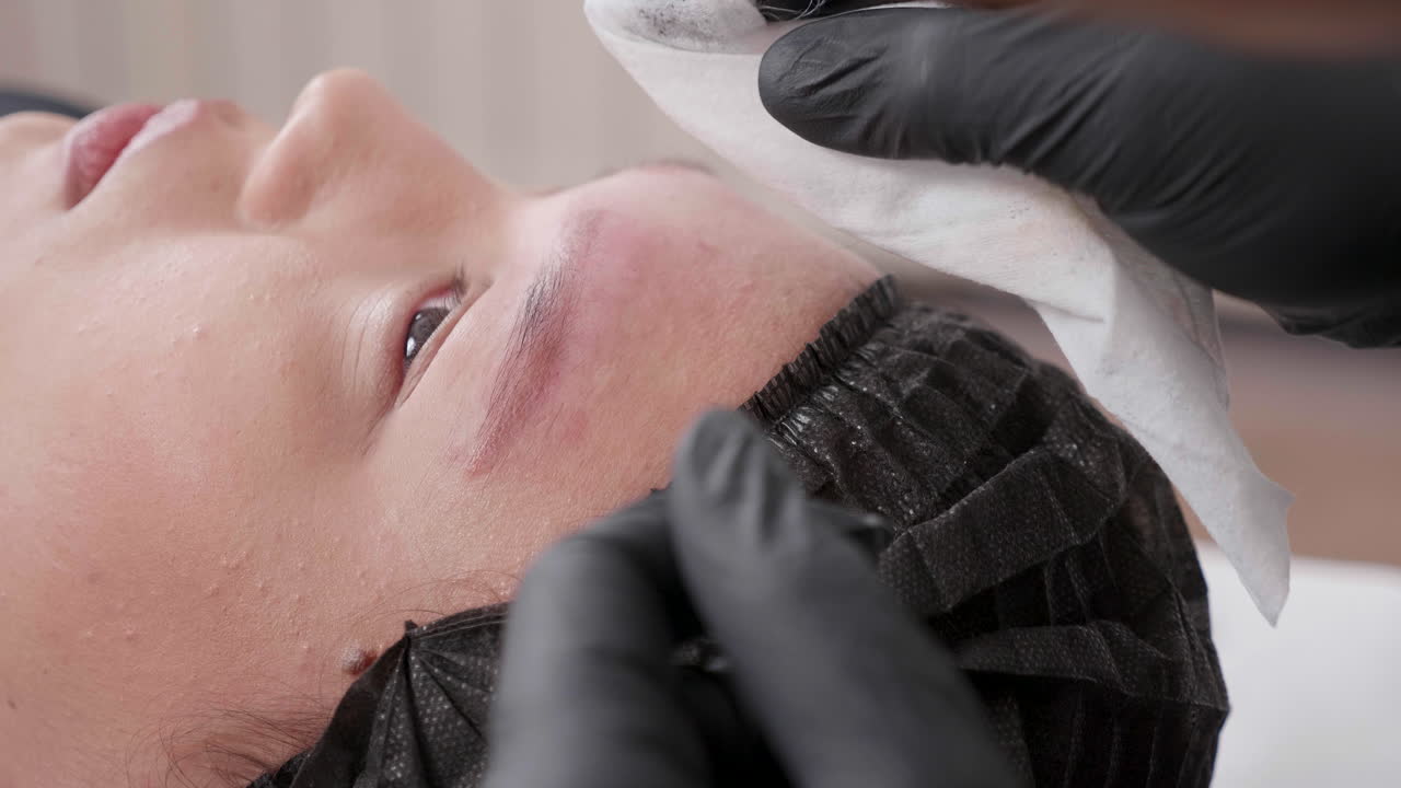 Tratamiento de belleza