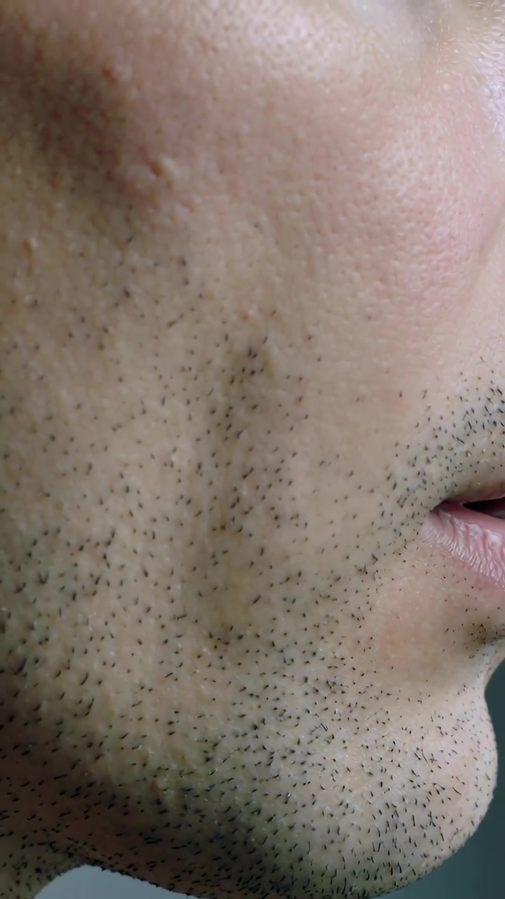 Video verticale: Ripresa di un uomo con la guancia destra in primo piano che fa piccoli cenni con la mascella davanti a una parete verde, con barba incolta e pori.