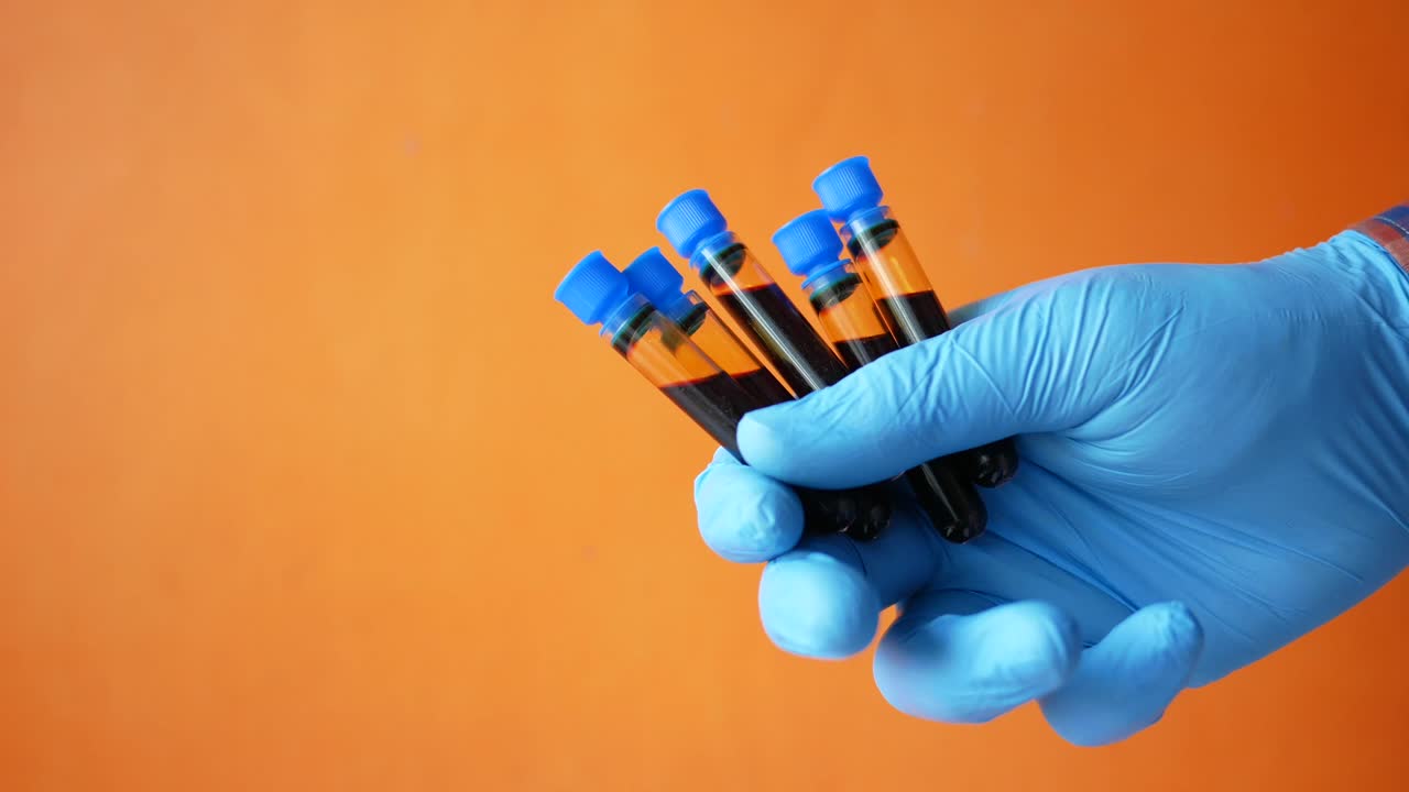 tubos de ensayo con muestras líquidas en la mano