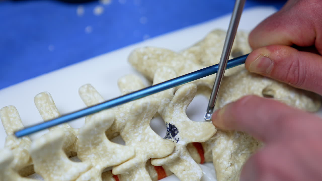 Advanced metal tools are demonstrated on the dummy of human spine. Male hands use the instruments on the model of vertebrae. Close up.