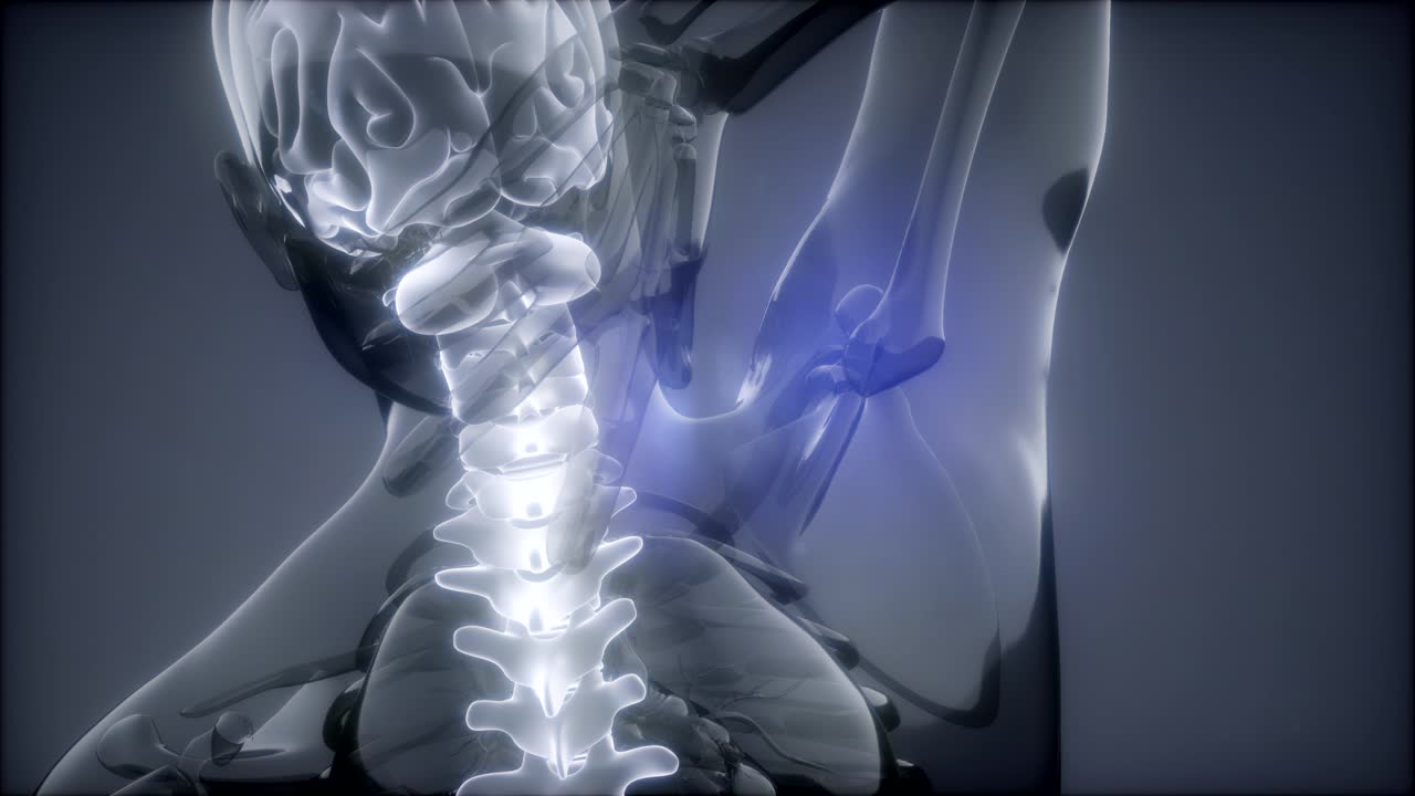 허리  ⁇ 에 허리 통증