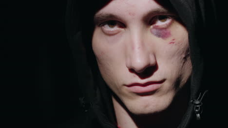 retrato de un hombre golpeado con un hematoma debajo del ojo